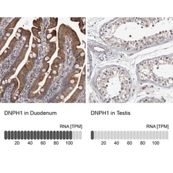 c-Myc-responsive protein Rcl Antibody, Novus Biologicals:Antibodies:Primary